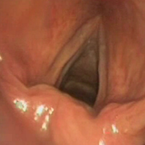 FA Pneumologie: Anatomie 1