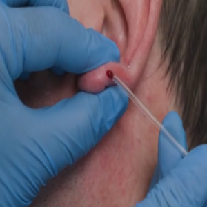 FA Pneumologie: Blutgasanalysen 1